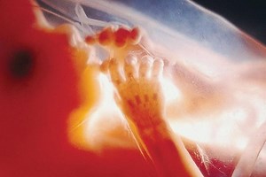 Life's Greatest Miracle