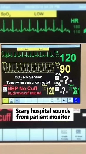 They said this is the scariest sound in hosoital, do you agree? #medical #patientmonitor #hospital #health #healthcare #patient #fyp #SINOHERO