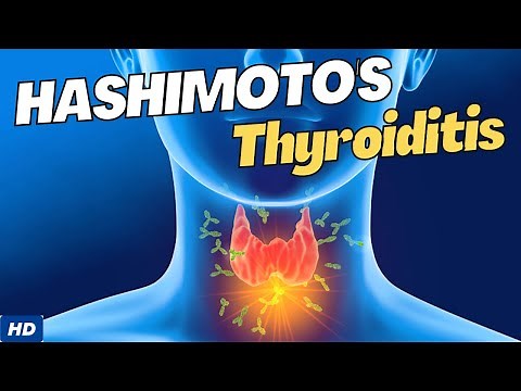 Hashimoto's Disease: Causes, Symptoms and Treatment