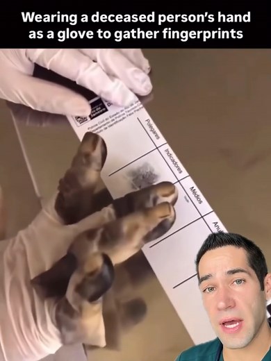 Impact of Fingerprints on Forensic Science