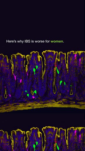 UC San Francisco (UCSF) | New research shows that estrogen can activate a hidden pain pathway in the colon, triggering gut cells to release serotonin and amplify... | Instagram