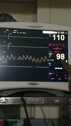vitals monitor/#monitor#vital#vitalsigns#viralvideo#viralshorts