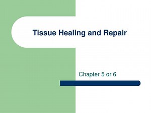 Tissue Healing and Repair Mechanisms: A Comprehensive Guide - SlideServe