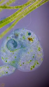 26K views · 306 reactions | Stentors are resilient micro animals. Check this stentor coeruleus out for example. It may have been destroyed when filamentous algae were added to the slide, but that doesn’t mean it’s waving the white flag. You see this big blue chunk attached to the stentor? This chunk is going to regenerate into a whole new healthy stentor. #MicroscopicMonday 匿  by @tardibabe/IG | Science Channel | Facebook