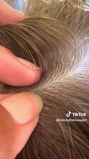 Professional Lice Removal Service: Expert Lice Removal Tips and Techniques