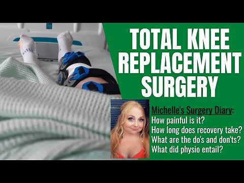 Total Knee Replacement Surgery | A Full/Honest Story: Pain, Physio & Life After...