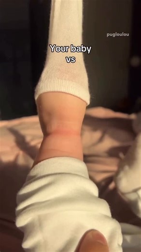 Sue O'Very I Serger Coach on Instagram: "We’re all proud of our little babies feet aren’t we? 🤣 👶👣🎀 All joking aside I actually do remember making crocheted booties for my daughter when she was a baby…but that’s a story for another day. These days I’m obsessed with serger presser feet and teaching my students how to use them. I’ve got a video dedicated how to show three presser feet and the star 🌟 is the gathering foot. ✨ I also show you two other presser 