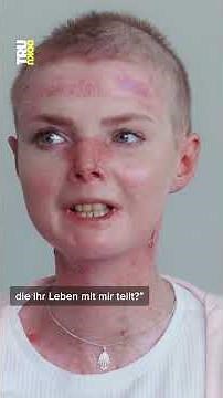 Herausforderung: Schmetterlingskrankheit #schmetterlingskrankheit #trudoku #zdf #tru