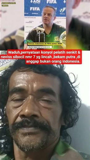 Wow, ridiculous statement from Senkits & Nevis coach number 7 is not a human being