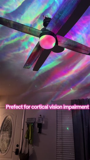 A projector light is a must have for kiddos with CVI!! #corticalvisualimpairment #lowvision #CVI #blind #meningitis