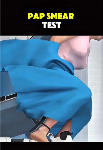 Understanding the Pap Smear Test with 3D Animations