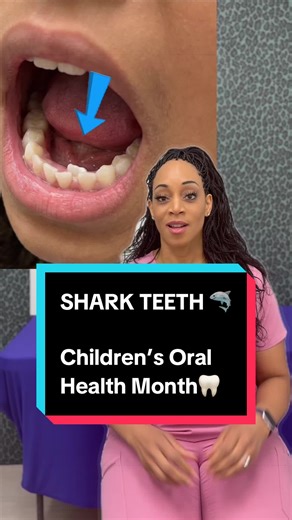 Your kid growing a second row of teeth? 🦷😱. Don’t panic, “shark teeth.” are more common than you think!🦈 It’s Children’s Oral Health Month, so we’re sharing helpful dental facts for parents. If you’re near DC and ready for the best care in the city for your little one, Comment “SHARK” and we’ll send you the link to book a consultation. #SharkTeeth #ChildrensOralHealthmonth #SpongeBob #MomLife #SharkTeeth