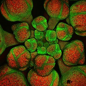 Définition | Microscope confocal : qu'est-ce que c'est ? | Futura santé
