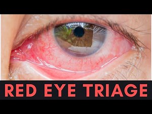 Red Eye: Urgent vs Non-Urgent | Triage Guide for Clinicians