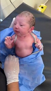 “Cutest Newborn Moments Ever 👶💗 Heart-Melting Reactions! #newbornbaby #cute #babyreel #cutebaby