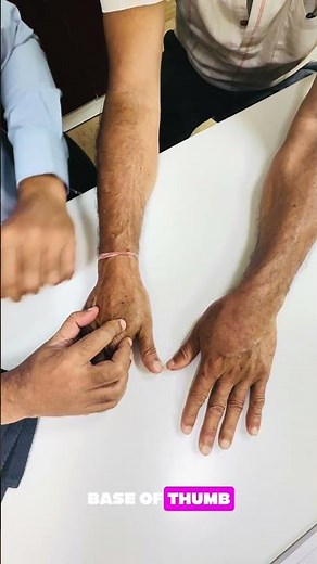Diagnosis and name of the Xray view?