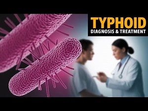 Typhoid Fever : Pathogenesis | Symptoms | Diagnosis and Management
