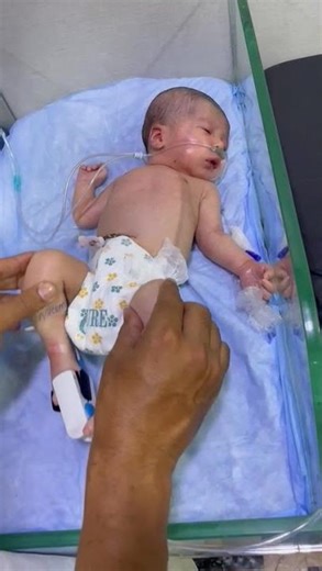 SPO2 as 61% #baby #neonatologist #cutebabies #newborn #ultrasound #cutechildren #newbornbaby