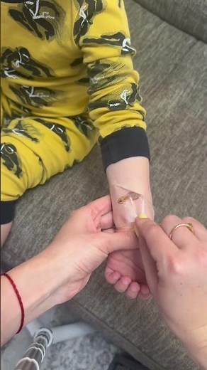 An easy way to remove a temporary tattoo from your kids skin #momhack #tattooremoval #momtips #easy