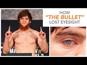 How Did Shara Bullet Lose His Eye?