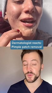 133K views · 45 reactions | Dermatologist reacts to pimple patch...
