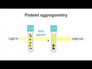 Ordering tests for bleeding coagulopathic patients