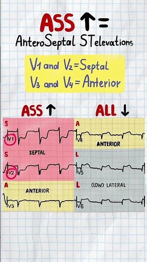 MI Localization ECG Mnemonic | USMLE Step 2 Cardiology High-Yield Review