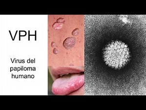 Know HPV - Diagnosis, Treatment and Prevention