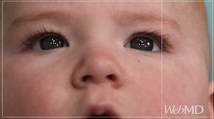 Have you ever wondered how a baby sees the world? Take a look at what they see as their vision develops over the first year. | WebMD