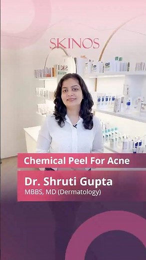 Chemical Peels for Acne: My Personal Experience and Results