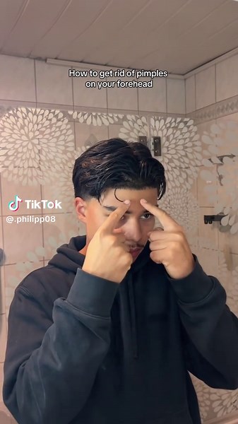 Effective Ways to Eliminate Forehead Pimples