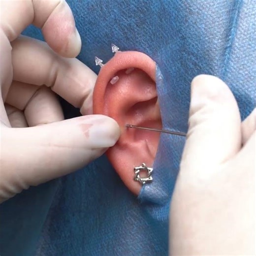 👂 Safe and flawless ear piercing method 💖💎🎯#trending #viral #piercing #tutorial