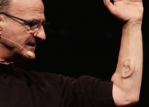 Stelarc, Performance Artist, Has Third Ear Implanted On His Arm - uInterview