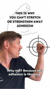 There are only a few approaches that effectively get rid of adhesion. If adhesion is your problem and your doctor or therapist doesn’t know how to recognize or treat it, you could be in for a whole lot of “rehab”that might leave you worse off than you started. #rehabscience #physicaltherapy #physiotherapy #stretching #adhesion #chronicpainwarrior #holistichealth #homistichealing #mke #milwaukee #mkemycity #wisconsin | Select Pain Care | Facebook