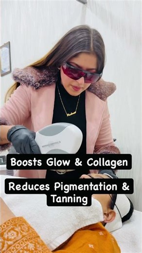 Laser Photofacial Treatment | Instant Glow ✨ No Filters