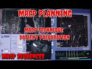 How To Do MRCP || Step by Step Guide to MRCP || MRCP Sequences & Planning || MRI Upper Abdomen, CBD