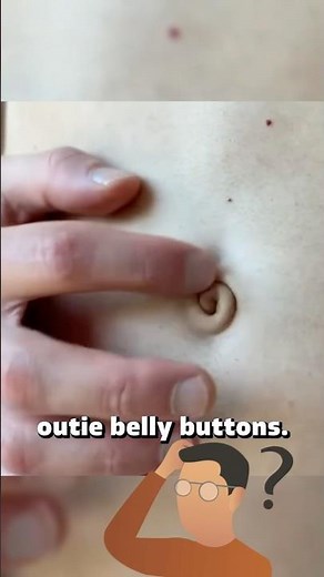 The Truth About Outie Belly Buttons😳🤔 #facts #medical