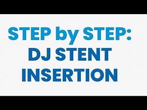 DJ STENTING: Step by Step pt education video on how DJ stents are placed in the ureters! #djstent