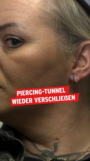 18K views · 46 reactions | Sünden der eigenen Jugend: Was, wenn das Tunnel-Piercing von vor 20 Jahren nur noch rumlabbert oder gar schmerzt? Janina hat die Ohrläppchen-Rekonstruktion gewagt. | rbb | Facebook