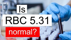 Is RBC 5.31 normal, high or low? What does Red blood cell count level 5.31 mean?