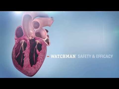 Watchman™ Left Atrial Appendage Occlusion