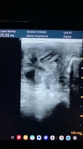 USB linear probe with color doppler function