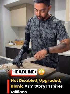This Bionic Arm Can Do Everything 😳🤖