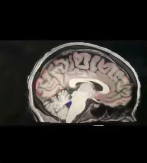 美国波士顿大学的科学家们拍下了“清洗”的全过程。红色是血液，蓝色是脑脊液，入睡后我们的神经元会安静下来，在几秒钟之后，血液将会从头部流出，然后，被称为脑脊液（CSF）的水状液体将会流入。
