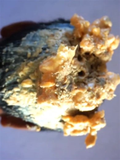 Dandruff treatment and cleaning #DandruffScratching #ItchyDryScalp #HugeFlakes #Dandruff #dandrufftreatment #satisfying #dandruffremoval #fblifestyle Disclaimer: Videos do not show original Dandruff,they are used for education purpose. Thank You,,, | Hit's