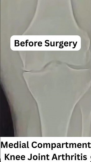 The Ultimate Guide to Fast Recovery and Pain-Free Mobility with TUKS