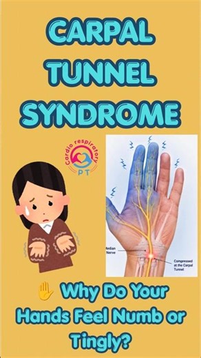 Carpal Tunnel Syndrome: Symptoms You Should NEVER Ignore! #shorts