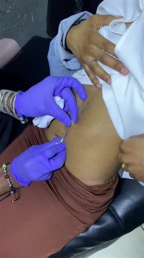 SEJA BEM-VINDO Queres uma #tatuagem melhor ou idêntica puxa e faz a tua 📅 marcação 🥰 WhatsApp 935460365 P >>>🇦🇴 🥰 SERVIÇOS DISPONIVEIS • APLICAÇÃO DE • TATUAGENS • PIERCING NORMAL • PIERCING MICRODERMAL ❗️Tatuagens #Temporárias uma semana • MICROPIGMENTAÇÃO «LABIAL-SOMBRACELHAS» • REMOÇÃO DE TATUAGENS • E muito mais 🥰🥰 @chocolath_tattoo_official 🍀🌺 Preço Inicial ds #TATUAGENS 7mil adiante (p cima) 📍 Estou localizado na rua principal da samba na paragem do morro da luz Antes da discotec