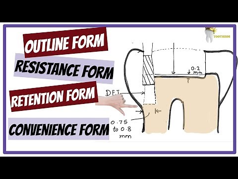 4 Steps of Cavity Preparation MADE SUPER EASY | Tooth Preparation | STUDERVANT