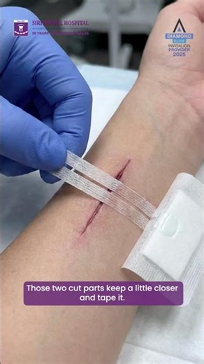 Hearing the word “stitches” can make anyone nervous 😟